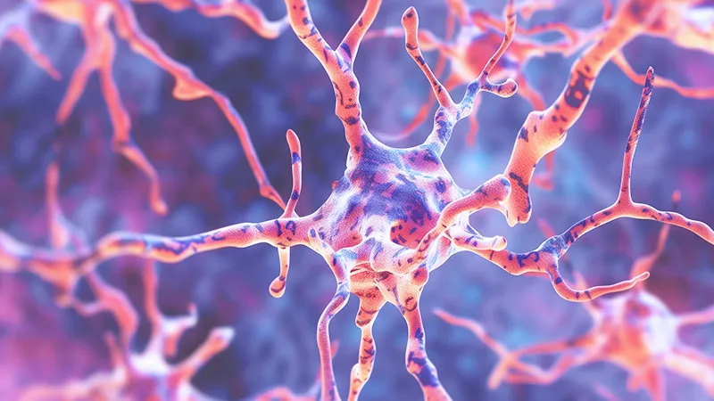 Image of the CJD pathogen